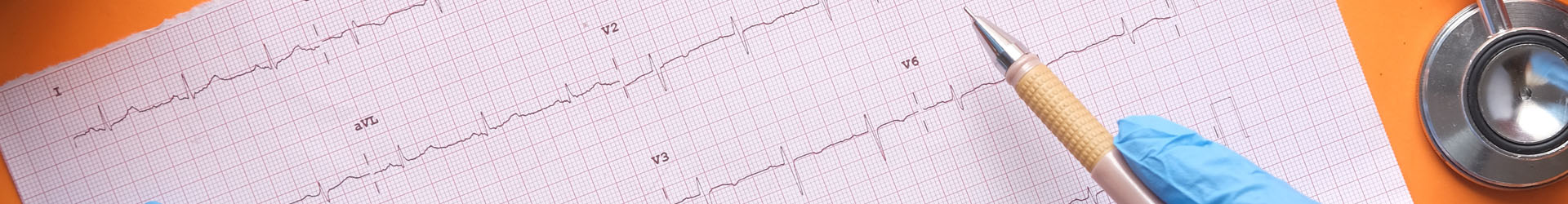 ECG12导联